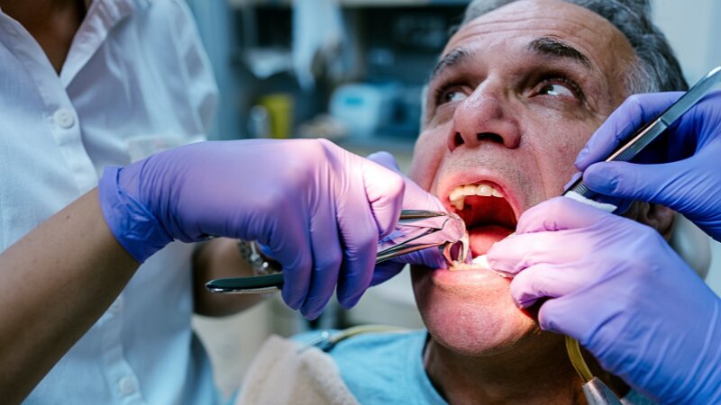 Une chirurgie d'extraction dentaire sur un patient