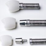 Photographie décomposée d'implants dentaires