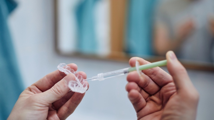 Un dentiste qui applique un produit de blanchiment dentaire sur une gouttière