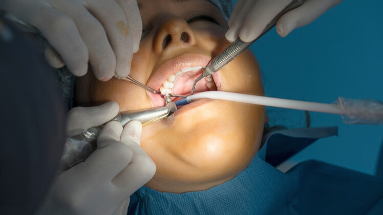 Une chirurgie d'implantation dentaire en zircone