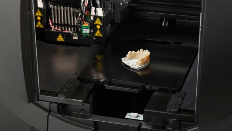 Une impression 3D dentaire