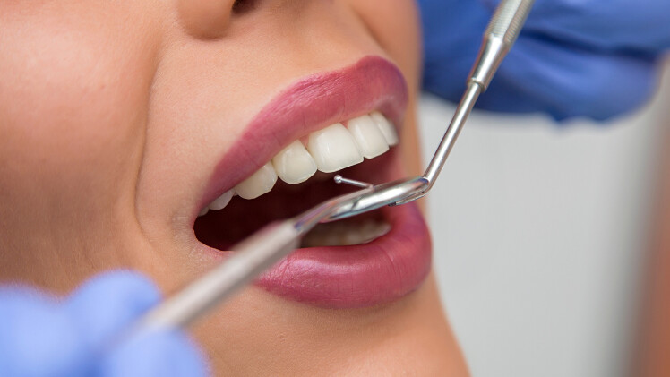 Une patiente qui fait controler ses implants dentaires par son dentiste
