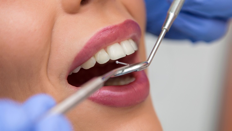 Une patiente qui fait entretenir ses inlays chez le dentiste