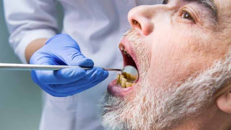 Un sénior chez le dentiste à cause de ses dents qui s'écartent