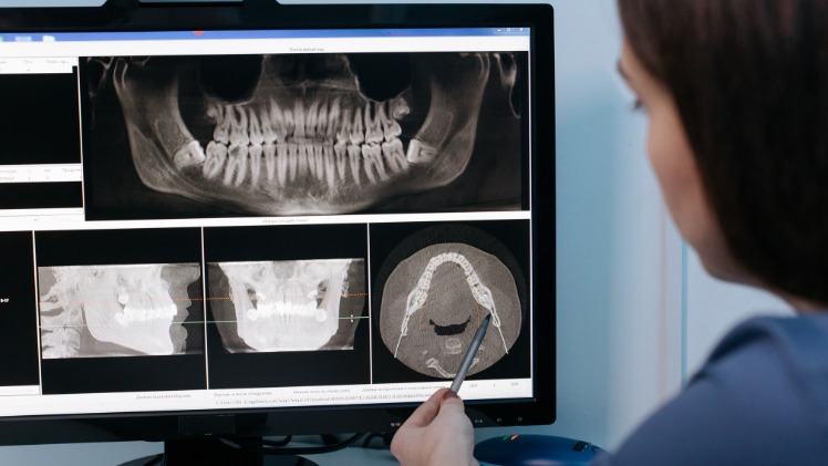 Une femme dentiste qui étudie la radiographie dentaire d'un patient