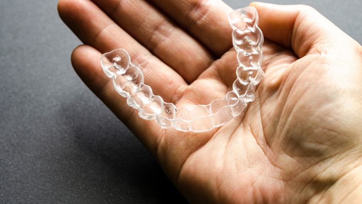 Une gouttière dentaire pour prévenir les risques de serrement des dents