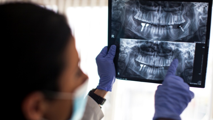 Un dentiste qui analyse la structure osseuse d'un patient