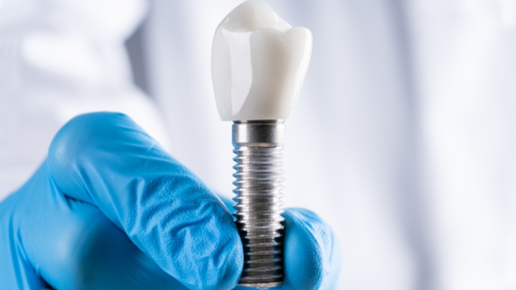 Un dentiste qui montre un implant dentaire