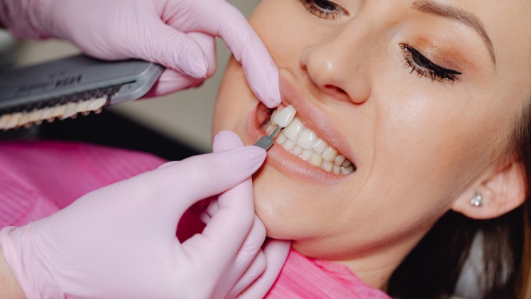 Un dentiste en train de choisir les facettes dentaires pour aligner les dents d'une femme