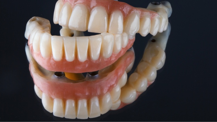Une prothèse dentaire fixe sur 2 implants