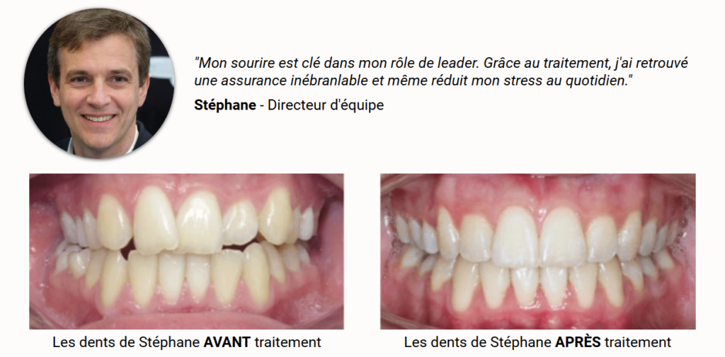 gouttière pour redresser les dents - Invisalign-avis client Stéphane - La Clinique du Sourie Die