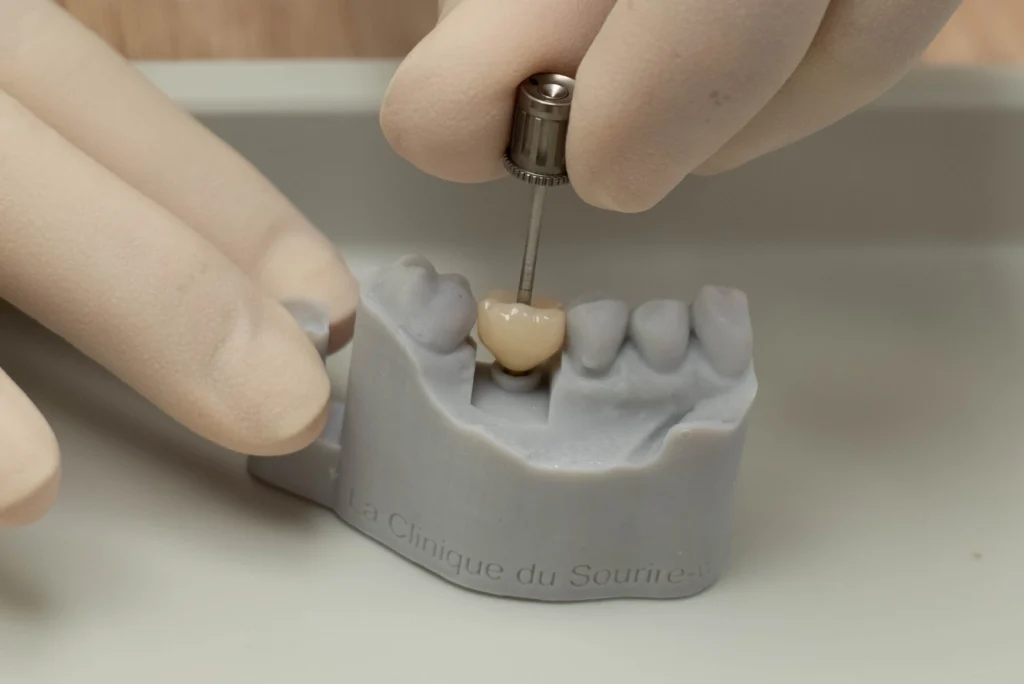 Composants d'un implant dentaire préparés à la Clinique du Sourire à Die
