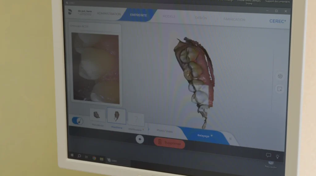 Imagerie 3D utilisée pour planifier la pose d'un implant dentaire à Die