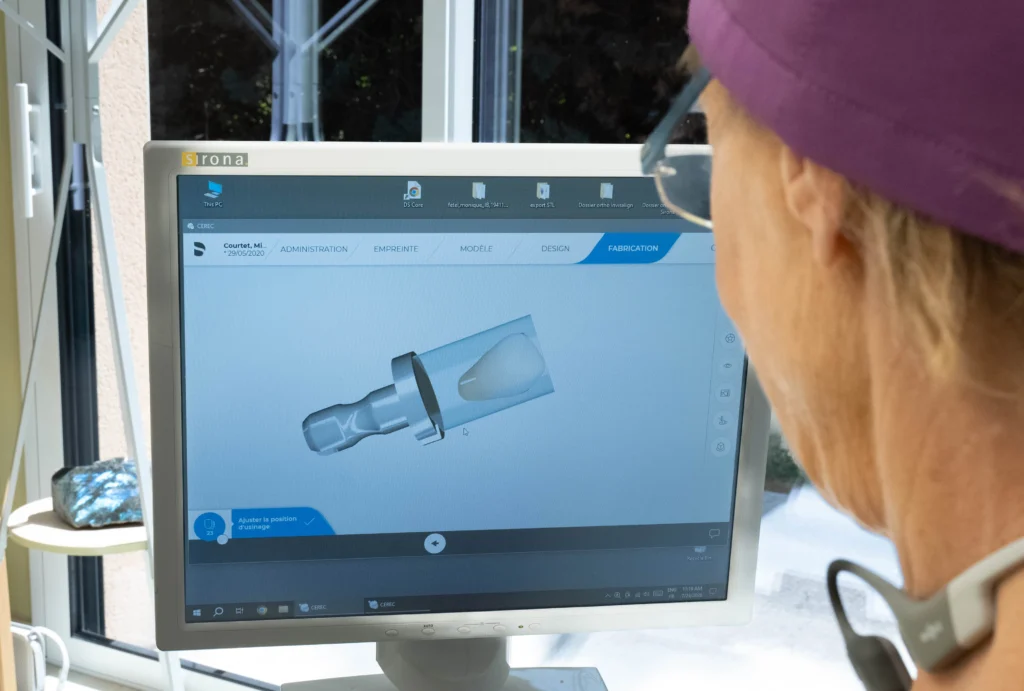 Le Docteur Isabelle Bertieaux visualise un projet implantaire en 3D