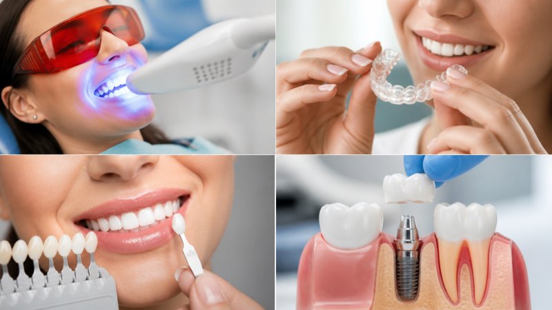 Comment avoir un beau sourire, les solutions
